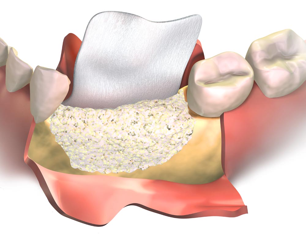 Chirurgia Orale Monza e Brianza - Studio Dentistico Rizzacasa